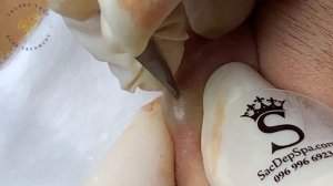 Satisfying Relaxing with Sac Dep Spa Video #576