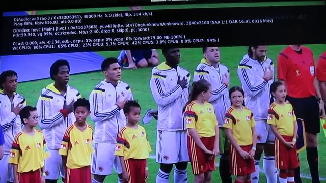 Zidoo X6 Pro Android TV Box Kodi 15 4K Video and HD Audio Passthrough Demo смотреть онлайн