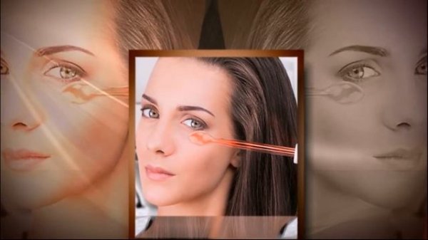 МОРЩИН можно теперь НЕ БОЯТСЯ? Дарсонваль от морщин