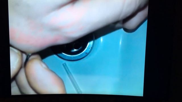 Гнойная заноза! Прыщ! Чёрные точки! Acne! Purulent splinter смотреть онлайн