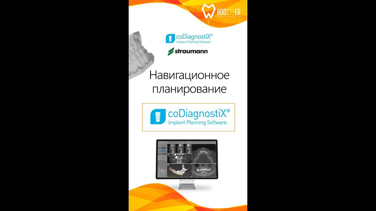 CoDiagnostiX - в чём преимущество?
