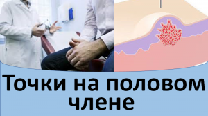 Точки на половом члене