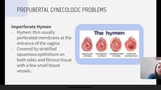 Pediatric And Adolescent Gynecology - Dr. Lasala