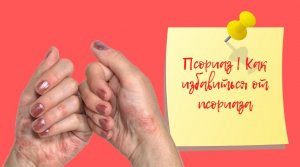 Псориаз | Как избавиться от псориаза