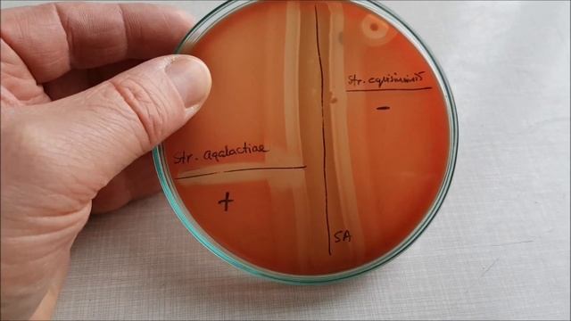 CAMP test for Streptococcus agalactiae - GBS смотреть онлайн