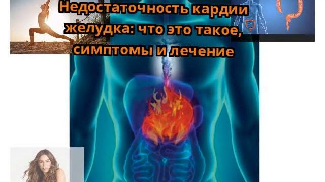 Недостаточность кардии желудка смотреть онлайн
