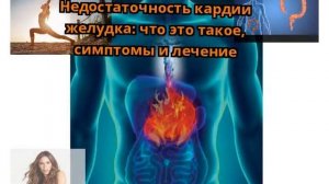 Недостаточность кардии желудка
