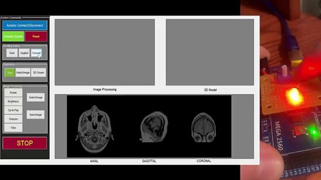 3D Segmentation and MATLAB Slicer смотреть онлайн