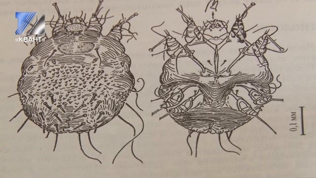 Сентябрь – пора активности чесоточного клеща смотреть онлайн
