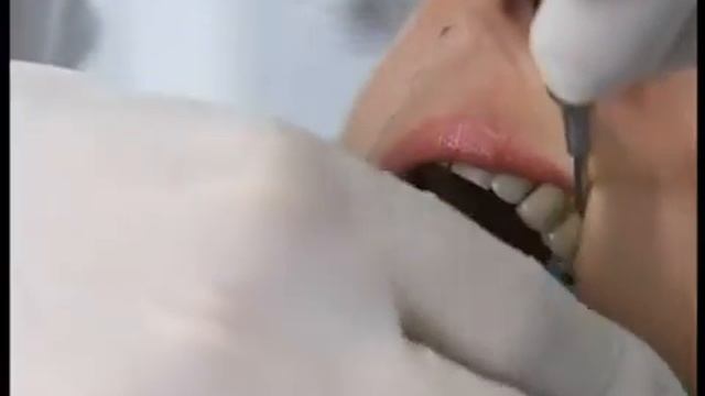 Прикусной блок. Mirahold Block. German смотреть онлайн