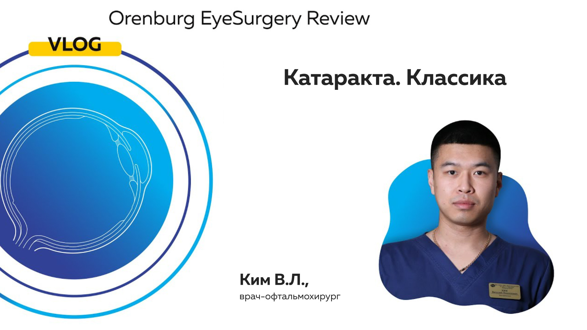 Катаракта. Классика