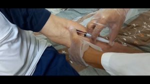 внутривенная инъекция