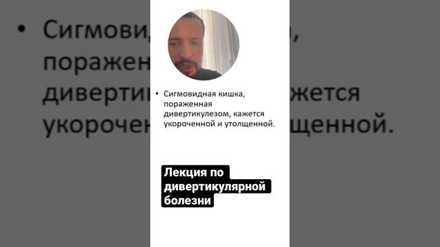 Фиброз сигмовидной кишки #shorts смотреть онлайн