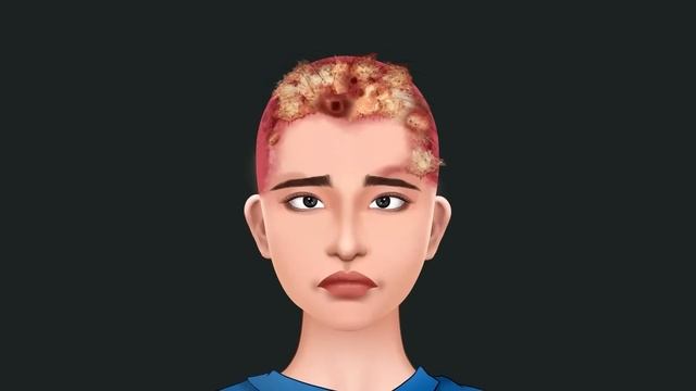 ASMR treatment and removal of lice and scabies scalp from the girl - 소녀의 머리에 옴의 치료 및 제거 смотреть онлайн