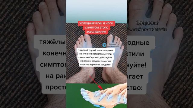 холодные руки и ноги симптом этого заболевания #народнаямедицина #здоровье #полезныесоветы #полезно смотреть онлайн