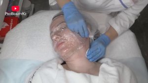 Механическая ЧИСТКА ЛИЦА петлей с применением вапоризатора. Подробно весь процесс от Елены Румынско