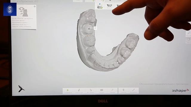 Внутриротовой сканер 3SHAPE TRIOS 3Pod. Пошаговая инструкция по использованию смотреть онлайн