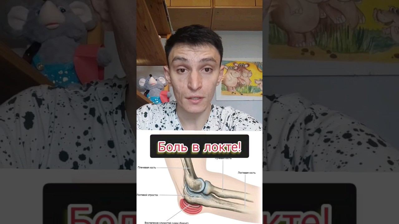 Боль в локте. #больвлокте #болитлокоть #больвлоктевомсуставе смотреть онлайн