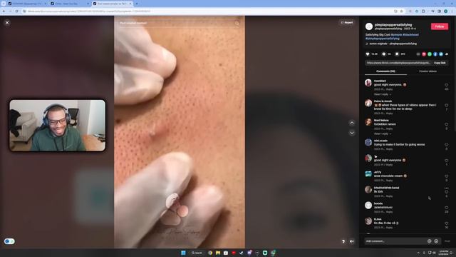 Popping Extravaganza: Celebrating 10,000+ Subs with the Best Pimple Pops смотреть онлайн