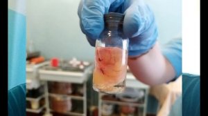 ГАЙМОРОТОМИЯ - НЕ ТАК СТРАШНО, КАК КАЖЕТСЯ