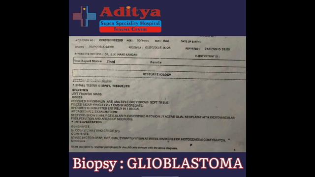 Glioblastoma Grade 4 Brain Cancer || Dr. SN Manikandan Neuro Surgeon & Director, Aditya Hospital смотреть онлайн