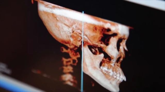 Grand клиника пластической хирургии в Сеуле смотреть онлайн