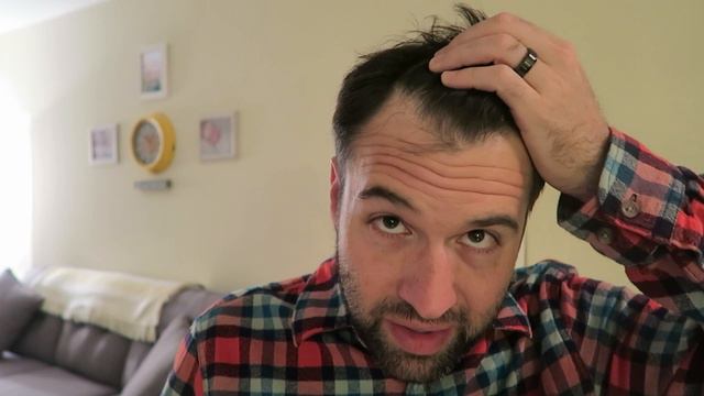 Rosemary Oil for Hair Loss: 11 Months Later смотреть онлайн