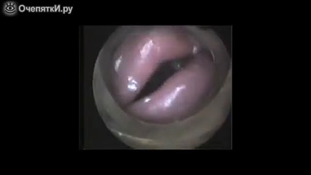 Губы тромбониста вид изнутри смотреть онлайн