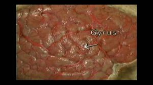 Оболочки головного мозга Атлас Окланда) 1