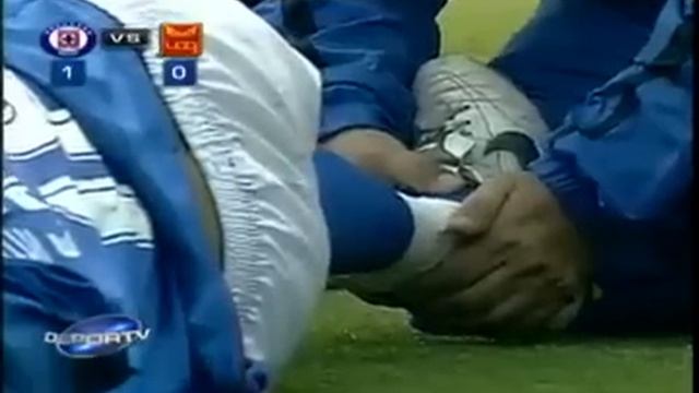 Worst Fracture Ever: Edgar Andrade смотреть онлайн