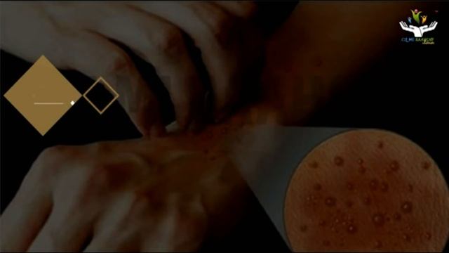 iska daawee cuncunka badan agagaarka cawrada | Xogta science-ka смотреть онлайн