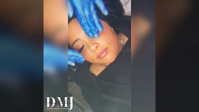 BioRePeelCl3 with Microneedling! смотреть онлайн