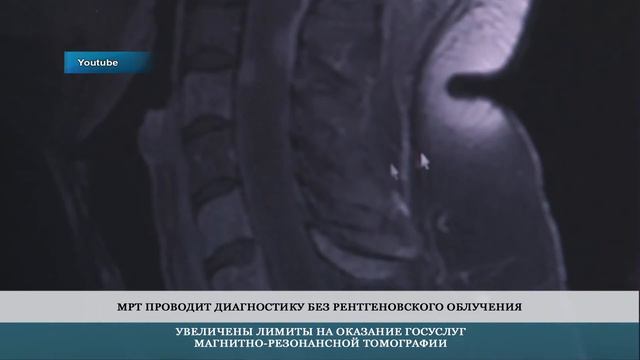 Увеличены лимиты на оказание госуслуг МРТ – 3.11.2022 смотреть онлайн