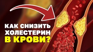 Как снизить холестерин? простые способы! Высокий сахар и холестерин в крови, что делать? Упражнения!
