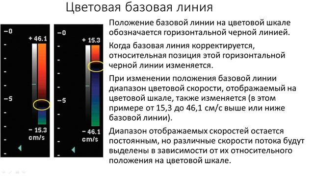 Особенности настройки УЗ аппаратуры и оптимизация изображения
