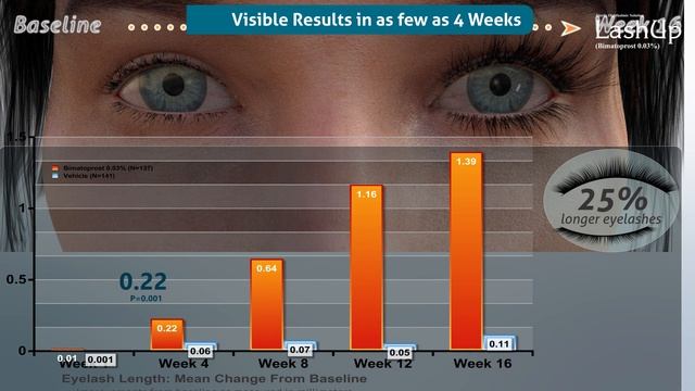 Grow your eyelashes naturally in 4 weeks with Lashup (Bimatoprost). Make it longer thicker & cute. смотреть онлайн