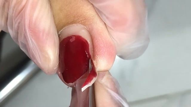 Beautiful Toenail Trim With Ingrown Nails!【Crazy Pedicure Room】