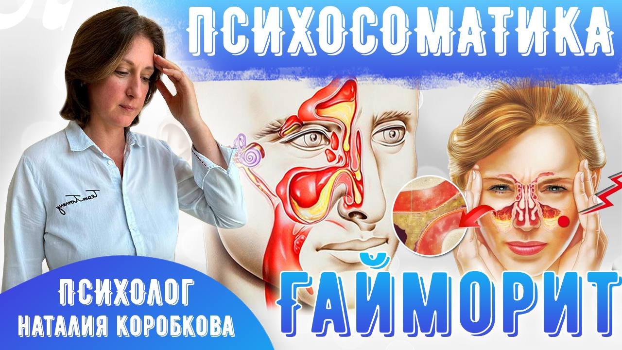 ГАЙМОРИТ: причины и чем лечить/Психосоматика смотреть онлайн