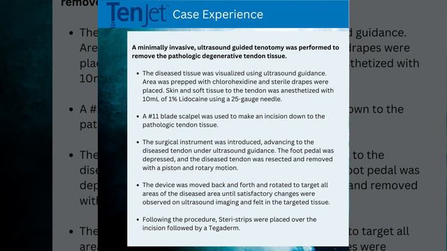 TenJet - Triceps Tendon Case Experience смотреть онлайн