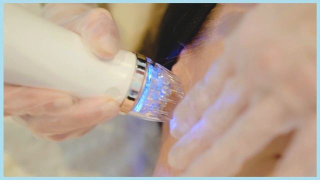 Tweak of the Week: Facial lifting and tightening with Secret™RF by Cutera | Alice Hart-Davis смотреть онлайн