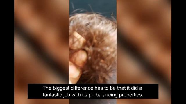 Best Shampoo For Dry Scalp And Oily Hair I Dry, Damaged Hair To Smooth Hair I Herbal Essences Revie