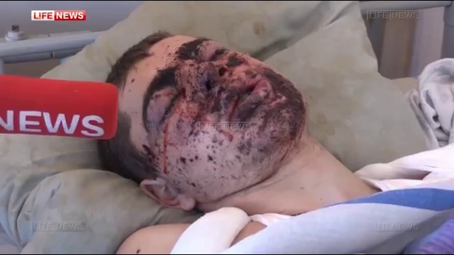 Раненый боец ВСУ признался, что его заставляли воевать смотреть онлайн