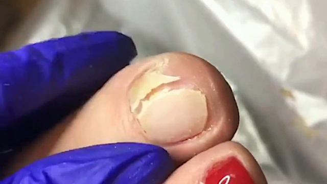 Последствия новой обуви😱⚠️❗️👟 смотреть онлайн