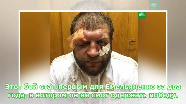 Александр Емельяненко опубликовал фото разбитого в бою с Джонсоном лица смотреть онлайн