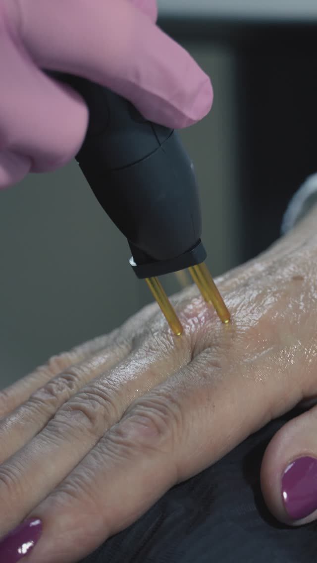 Омоложение кожи рук на аппарате NeoGen смотреть онлайн