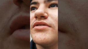 Подвешивание за яйца