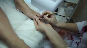 Как лечить грибок ногтей? Говорит ЭКСПЕРТ