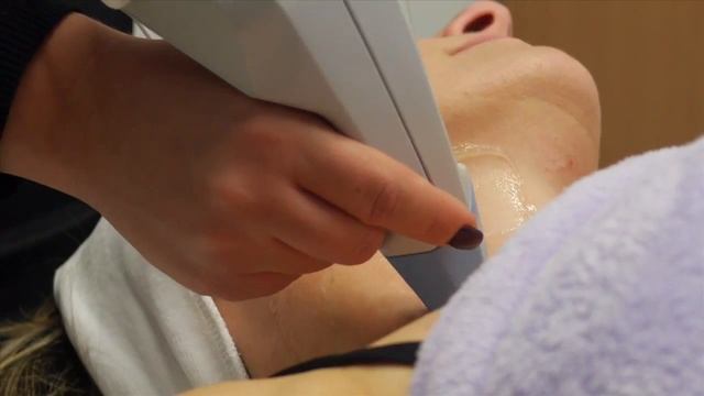 RF лифтинг лица EXILIS в линике Health and Aesthetics смотреть онлайн