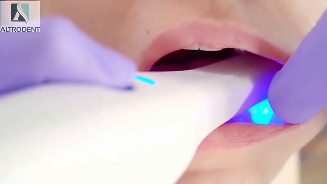 Интраоральный сканер Medit i500 смотреть онлайн