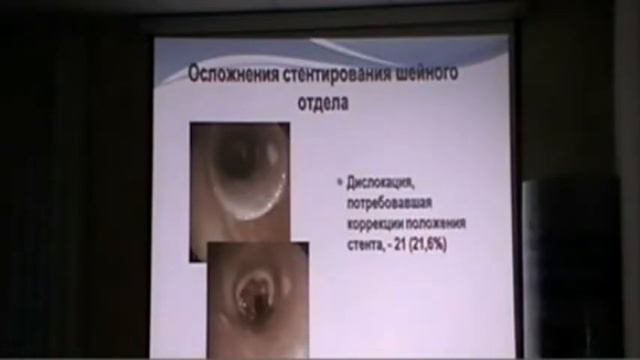 Принципы лечения грануляционного стеноза трахеи смотреть онлайн